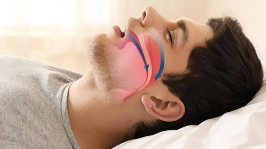 Doctors Say Drooling During Sleep May Reveal More About Your Health Than You Think