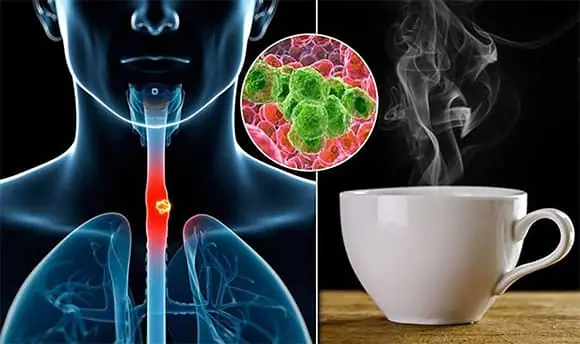 Doctors Warn: This Popular Drink May Increase Can.cer Risk Up to 6 Times if Consumed Regularly