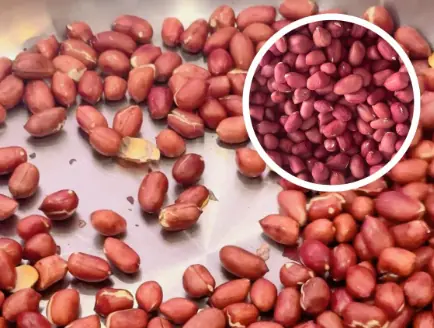 Eating peanuts every day? Here’s what doctors recommend you understand