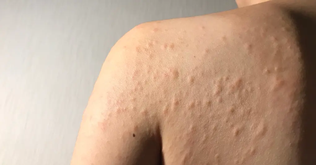 He Ignored the Symptoms Thinking It Was Allergies — Then Doctors Delivered Unexpected News