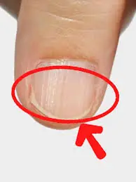 Nail Lines After 40? Here’s What Your Body May Be Trying to Tell You