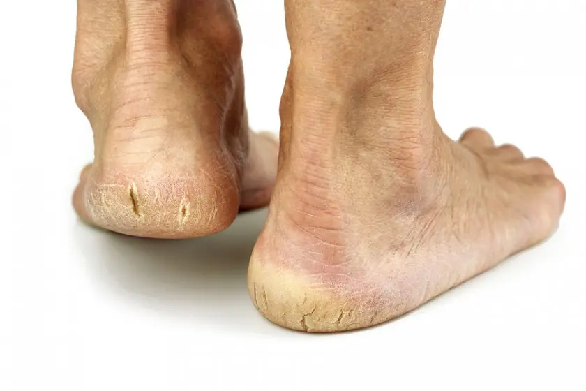9 Signs in Your Feet That Could Reflect Your Overall Health