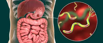 The Hidden Symptoms of Helicobacter pylori Many People Overlook