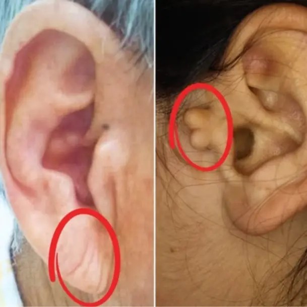 9 Ear Signs That May Reveal Hidden Hea.lth Prob.lems