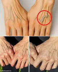 Are your hand veins suddenly more noticeable? Here’s what it could mean