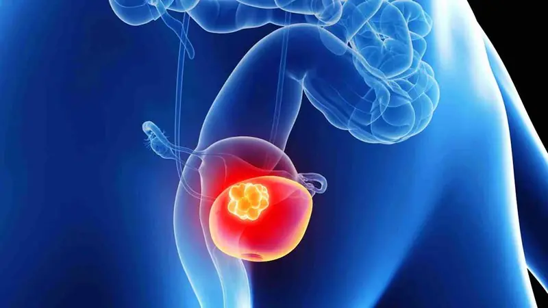 5 Things Your Body May Be Telling You About Bladder Health