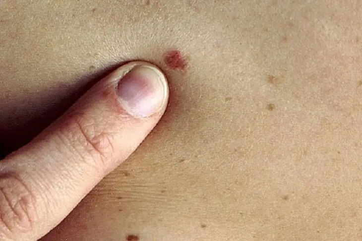 Red Skin Dots Explained: From Minor Irritation to Health Conditions