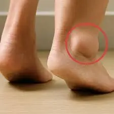 Swollen Ankles and Feet? Here Are Some Possible Causes