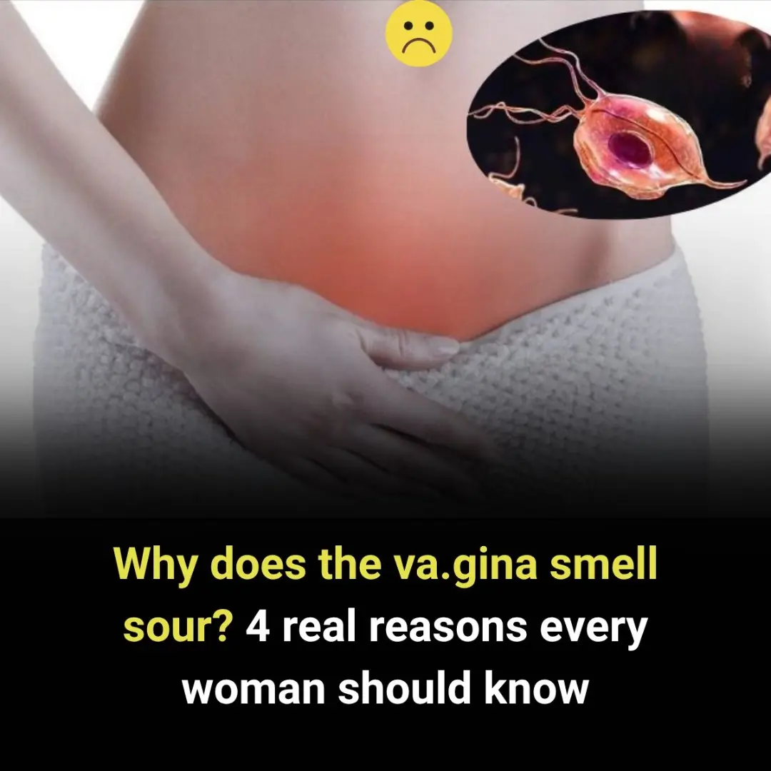 Why Does the Vaginal Area Smell Sour? 4 Common Reasons Every Woman Should Be Aware Of