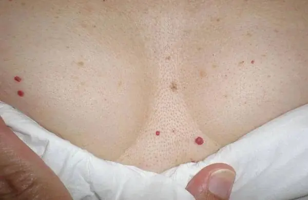 What Do Red Spots on the Skin Mean? Common Causes You Shouldn’t Ignore