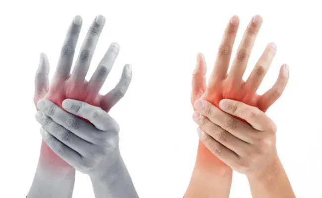 What Causes Hand Numbness — and the Simple Things That Can Help