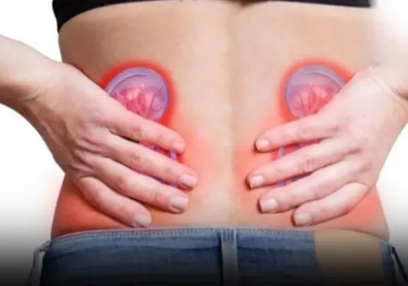 4 Simple Waters That Can Help Treat Kidney Stones Naturally
