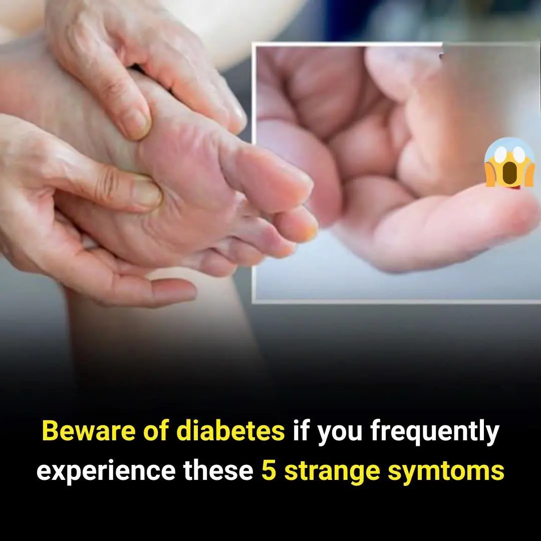 These 5 Unusual Symptoms Could Be Warning Signs of Diabetes