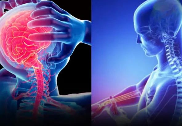 These Warning Signs May Appear Days Before a Stroke, According to Many Patients