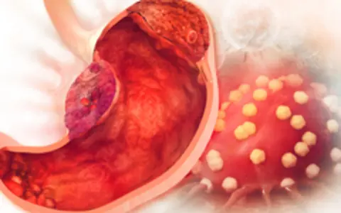 These 2 Hidden “Culprits” in Your Fridge May Be Worse for Your Stomach Than You Think