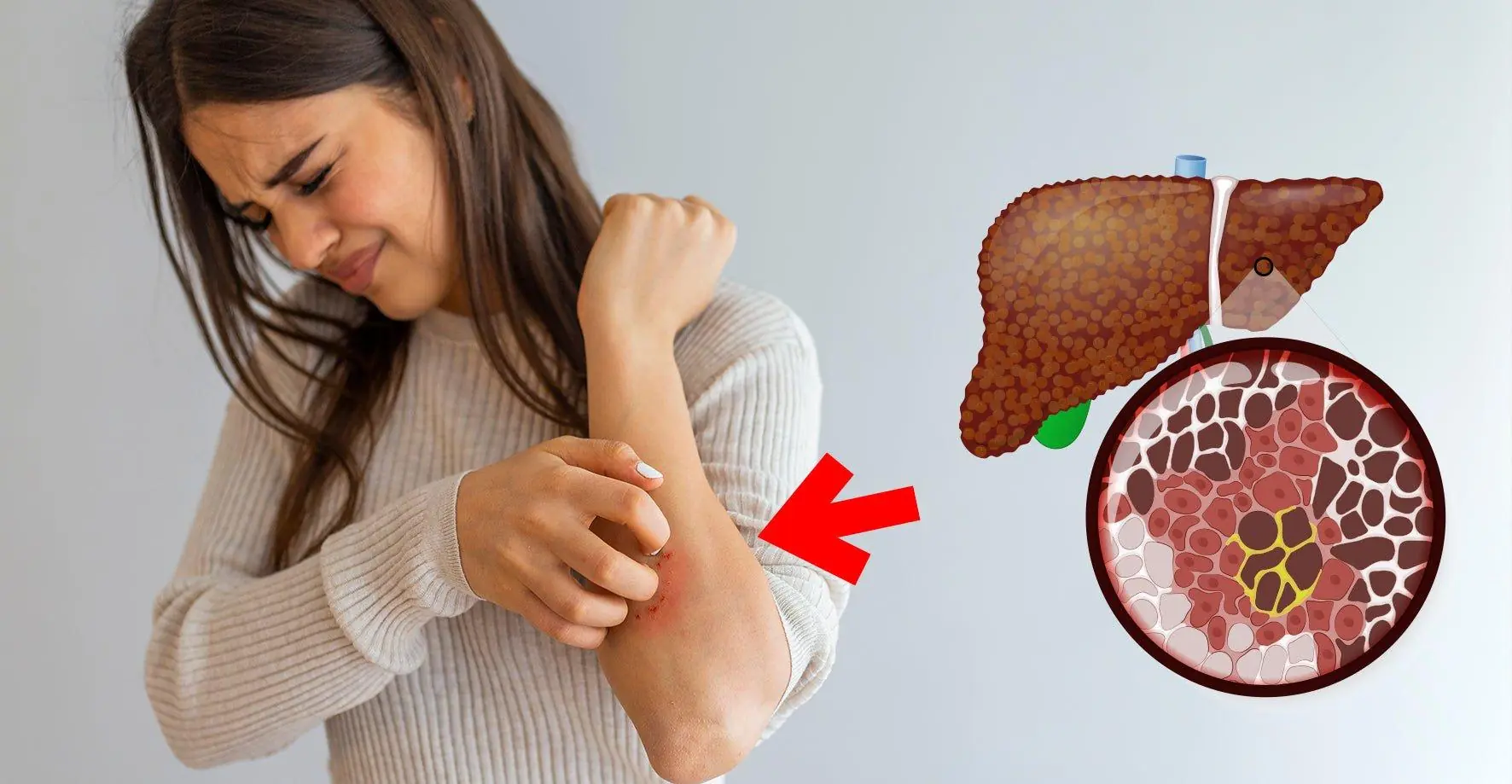 7 Skin Symptoms That Doctors Say May Be Related to Liver Disease