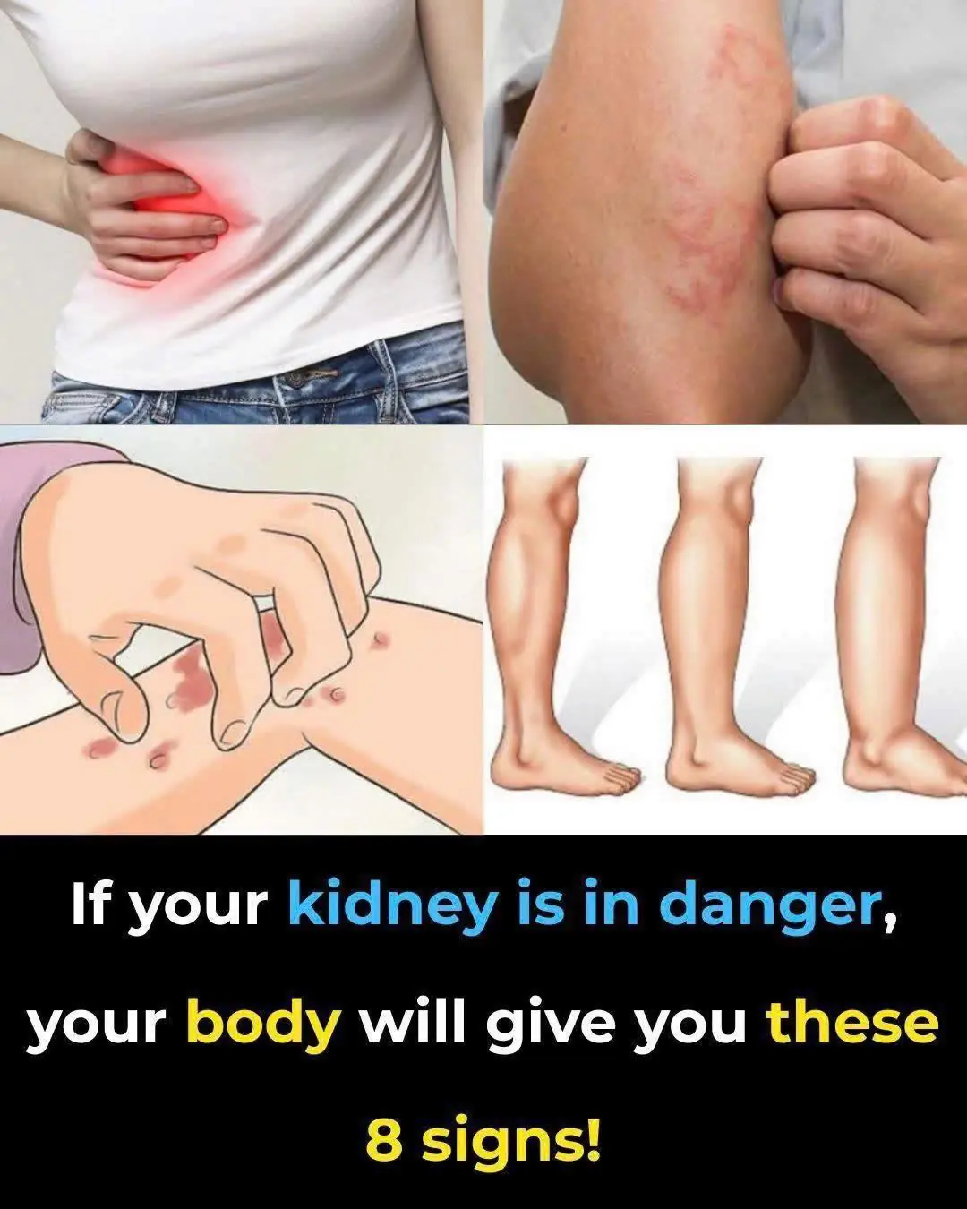 Your Body May Show These 8 Warning Signs When Your Kidneys Are Struggling