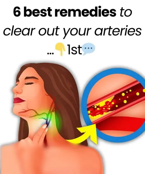 6 Best Tips to Support Clean and Healthy Arteries