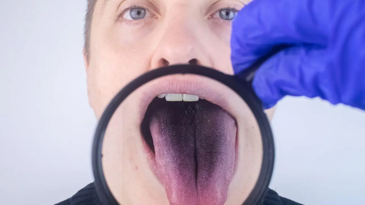 Your Tongue May Be Warning You About Serious Health Problems — 6 Signs Linked to the Li.ver, Kid.neys, and He.art