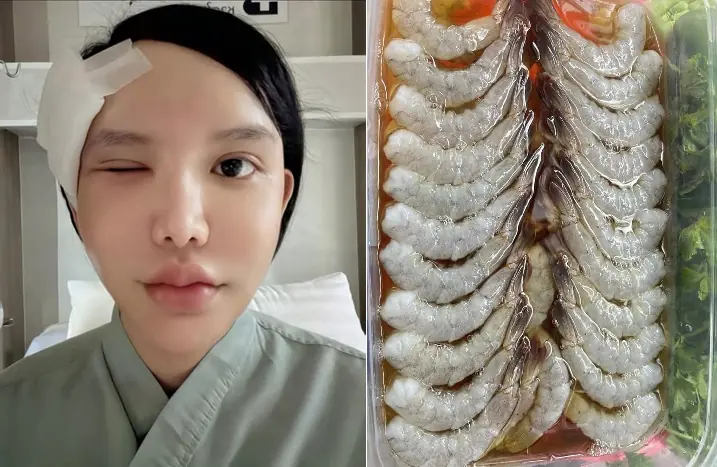 Woman Nearly Loses Vision After Parasite Invades Her Eye Socket — Doctors Warn About One Dangerous Habit Many People Still Have