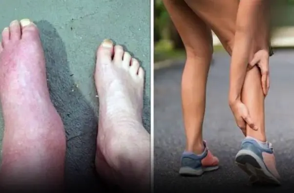This Foot Symptom Could Be a Serious Warning Sign You Shouldn’t Ignore