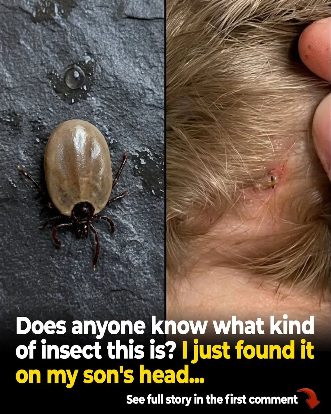 Does Anyone Know What This Insect Is? I Found It in My Son’s Hair…
