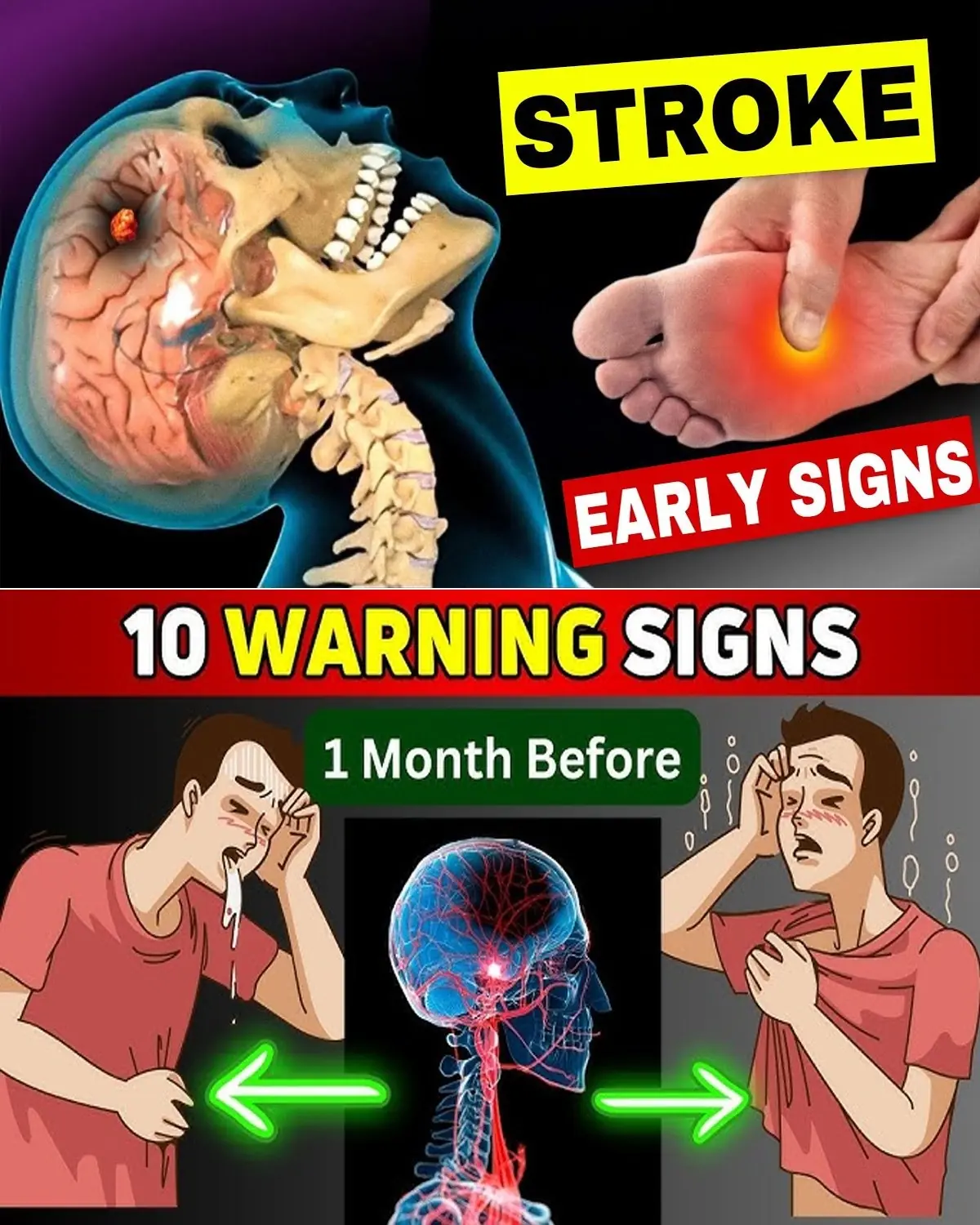 Stroke Warning: 10 Signs That Require Immediate Attention
