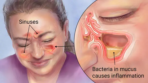 Too much phlegm? It could be a sign your body needs attention
