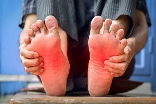 5 Unusual Signs in Your Feet That May Reveal Kid.ney Problems