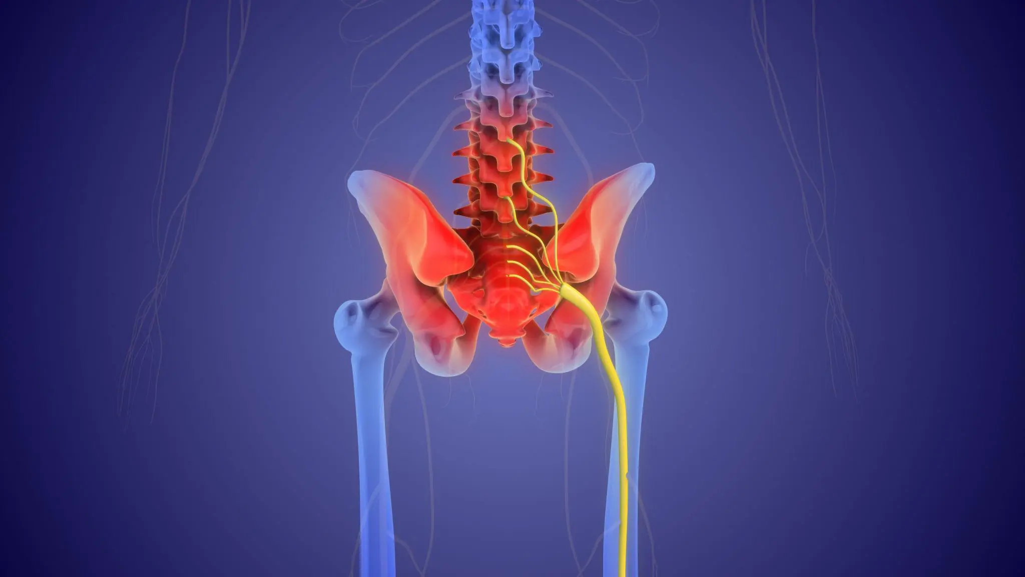 How to Treat Sciatic Nerve Pain Naturally: Simple Remedies That May Help