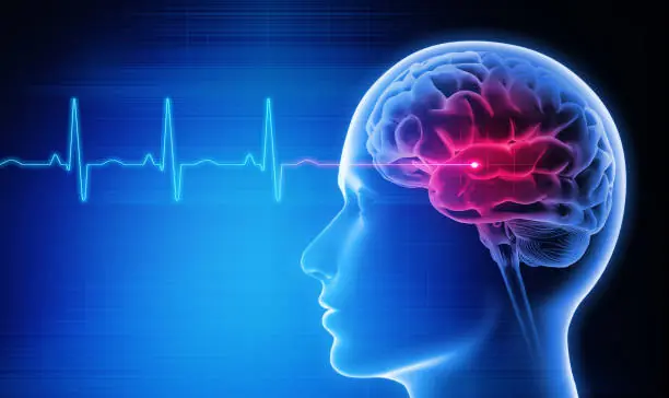 Unusual Headaches? Here Are 2 Signs Doctors Say You Should Never Ignore