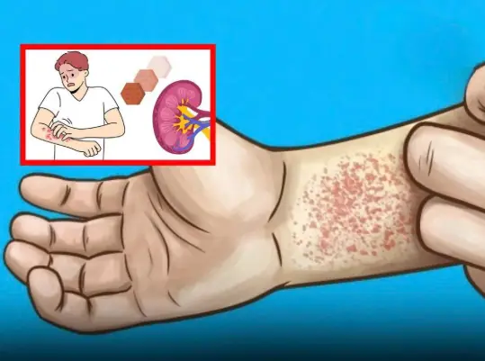 10 Silent Warning Signs Your Body May Be Showing About Kidney Disease