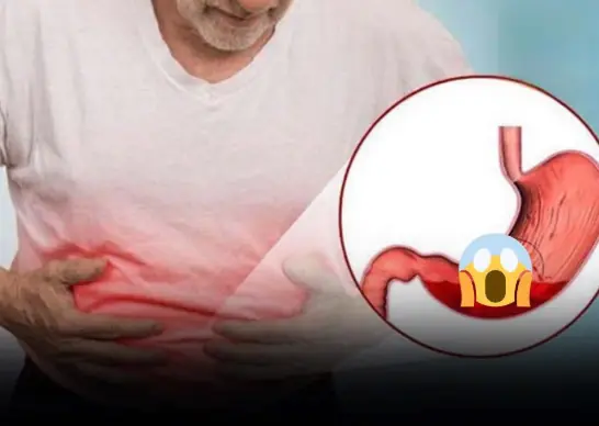 Doctors Say Even One of These 7 Symptoms Could Be a Warning Sign of Stomach Cancer
