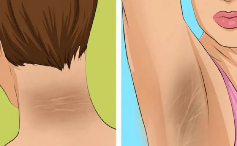 8 Silent Clues You’re Overloading on Sugar Without Realizing It
