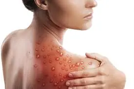 7+ Silent Fatty Liver Symptoms That Often Go Unnoticed