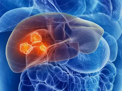 From Silent Infection to Li.ver Can.cer: How Hepatitis B Progresses in Just 3 Stages