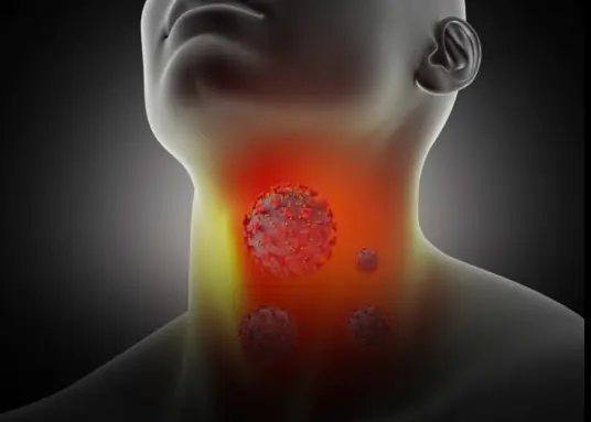 Constant Mucus in Your Throat? Here Are Some Unexpected Causes You Should Know About