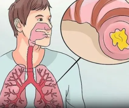 Clear Mucus Naturally With This Simple 2-Ingredient Home Remedy