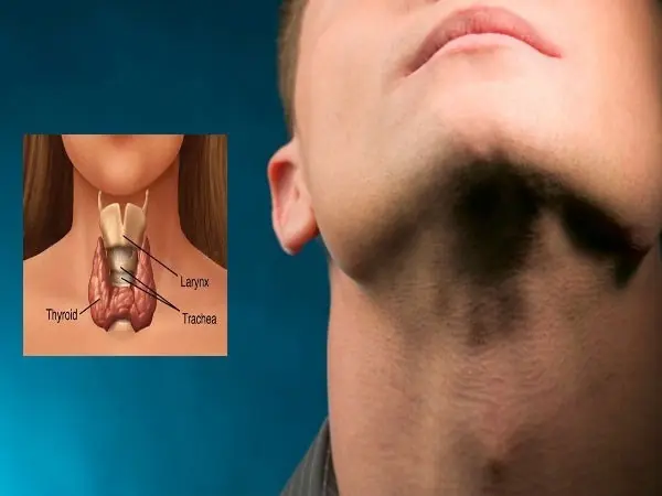 Which People Are Most at Risk for Thyroid Can.cer?