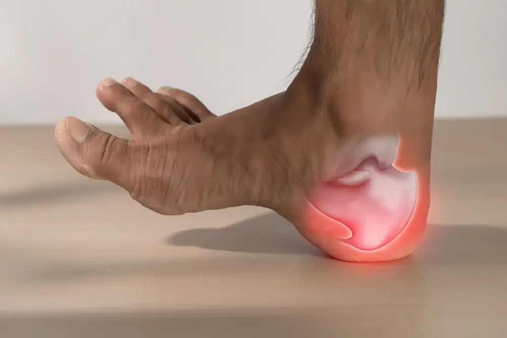 Heel pain when you first wake up? Doctors say it could be a sign of something deeper
