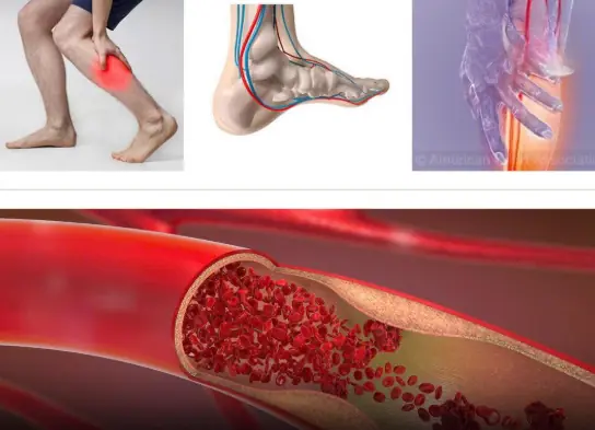 What Your Feet and Legs May Be Telling You at Night
