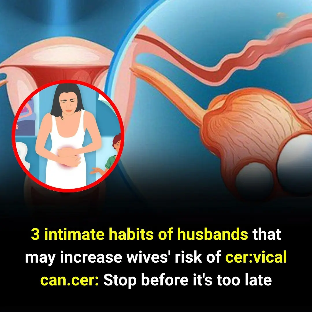 People at Higher Risk of Colorectal Cancer