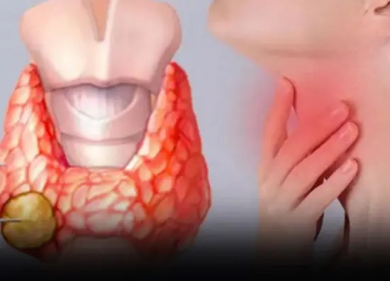 These 6 Foods May Not Be the Best Choice for Your Thyroid Health, Experts Say