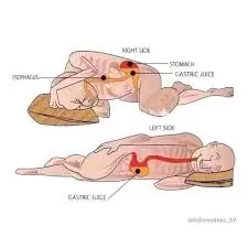 If you regularly sleep on your right side, it’s important to be aware that…