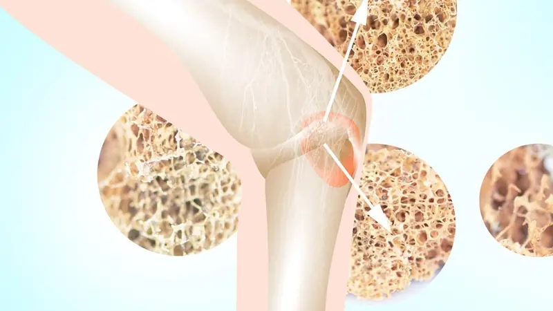 Your Body May Be Warning You About Low Calcium - Here Are 7 Signs to Watch For