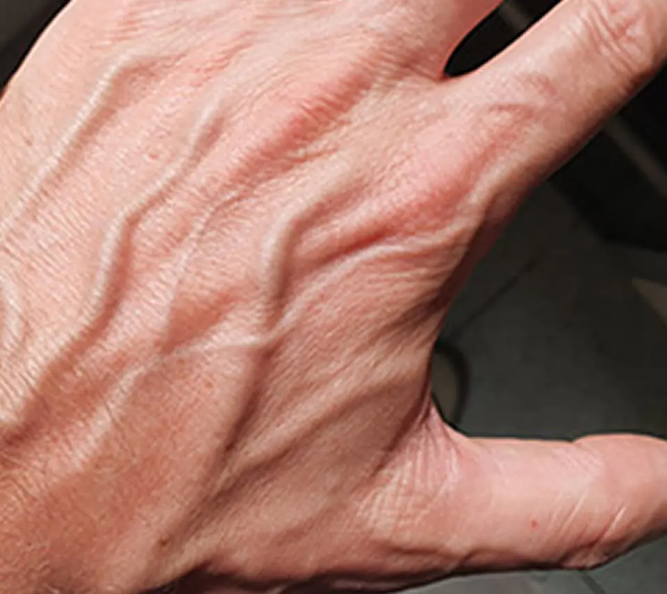 Have your veins become more noticeable lately? Here’s what health experts want you to know
