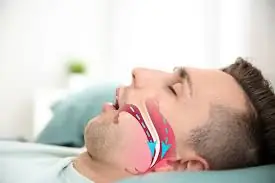 Is Your Snoring More Seri.ous Than You Think?