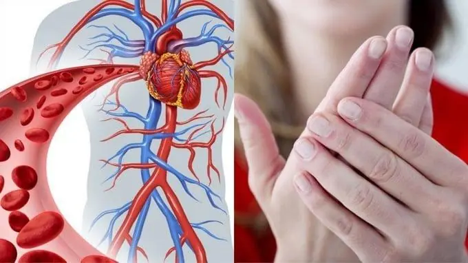 Tired of Poor Circulation and Varicose Veins? Try These 6 Effective Tips