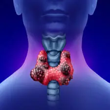 He Thought It Was Just a Sore Throat — At 35, He Ended Up Battling Cancer 😨 Doctors Urge People to Avoid These 2 Fridge Foods