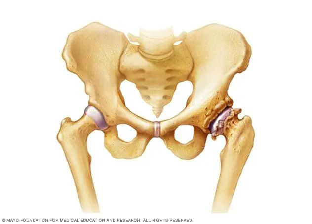 You Won’t Believe What Your Hip Pain May Be Trying to Tell You — Here’s What Doctors Want You to Know